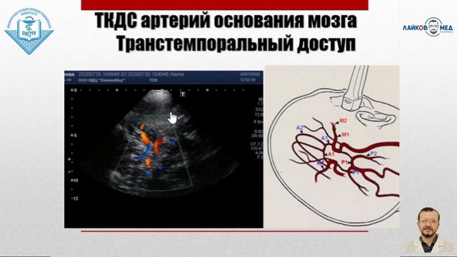 УЗИ брахиоцефальных сосудов, Часть 2 / Лайков Алексей Владимирович - врач УЗИ, к.м.н.