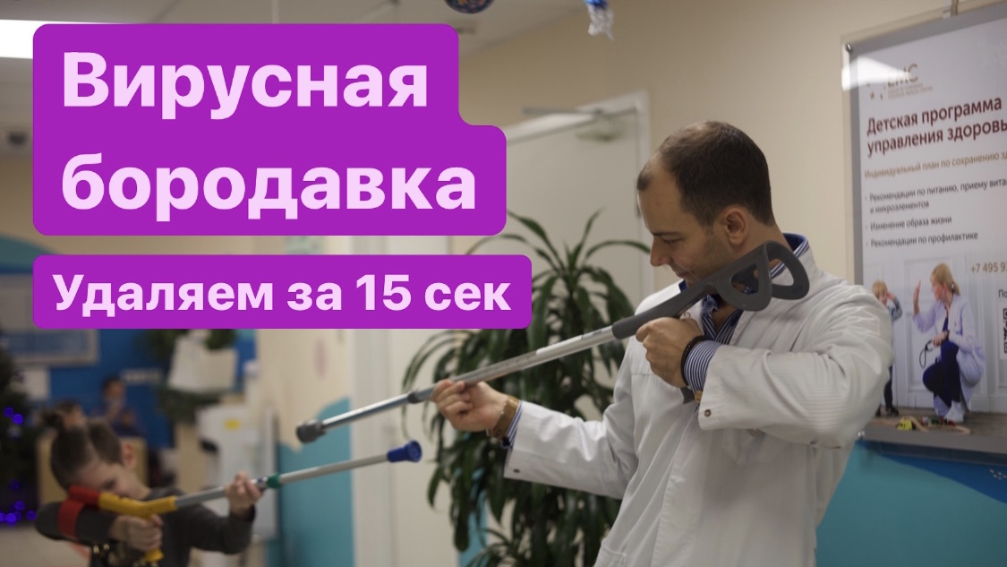 Вирусная бородавка стопы. Удаление за 15 секунд
