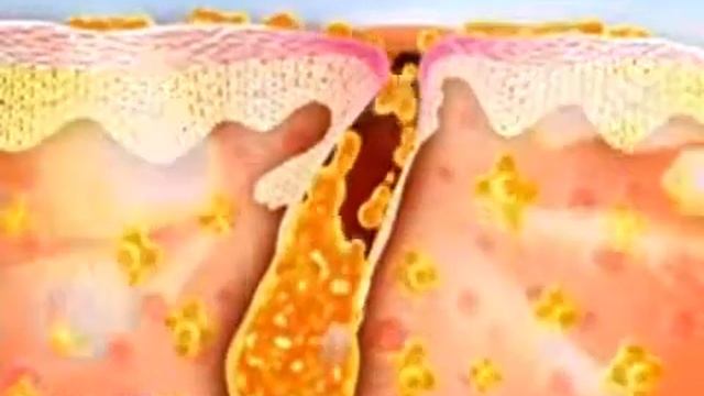 Демодекс Ру   самый большой ассортимент средств от демодекоза www demodex ru