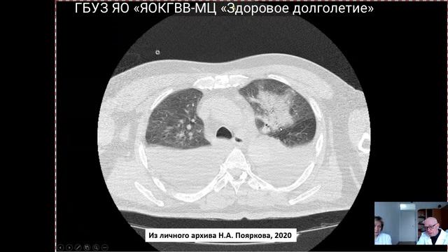 Внедрение клинических рекомендаций в реальную терапевтическую практику. (С заведующими)