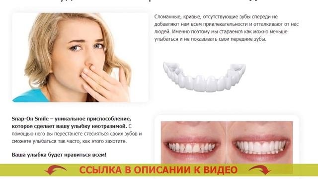 Накладки на зубы Ярославль