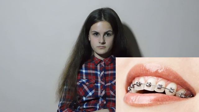 ВСЁ О БРЕКЕТАХ