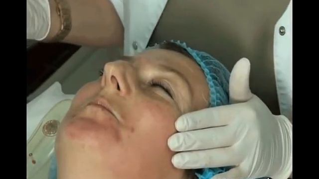 Микронидлинг. Работаем роллером