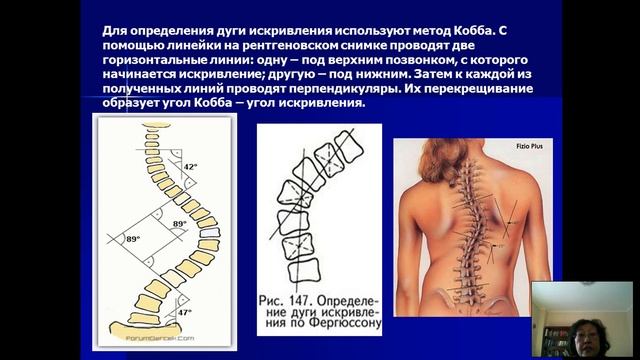 5 ЛФК в хирургии