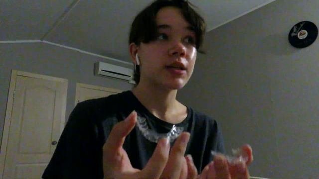 мне сняли брекеты! и удалили зуб мудрости