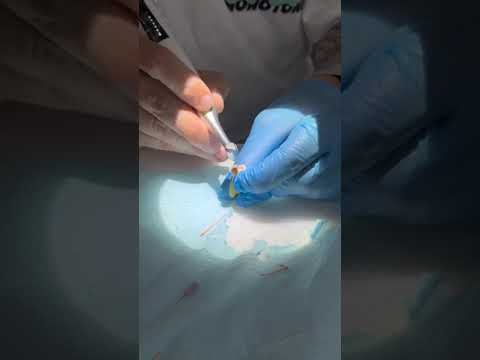 Работа в канале vatech стоматология smile