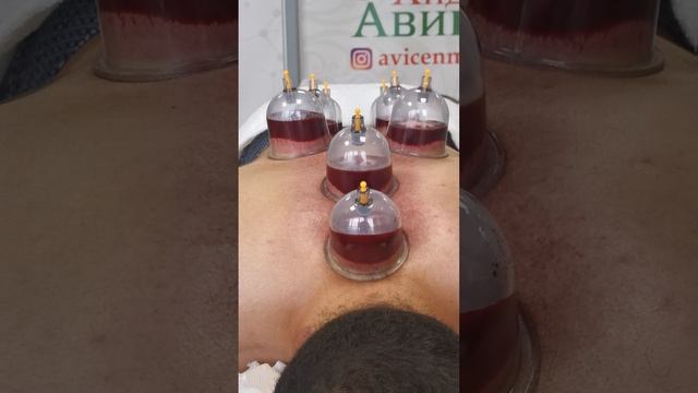 Персидский дагестанец делает Хиджаму после боя!