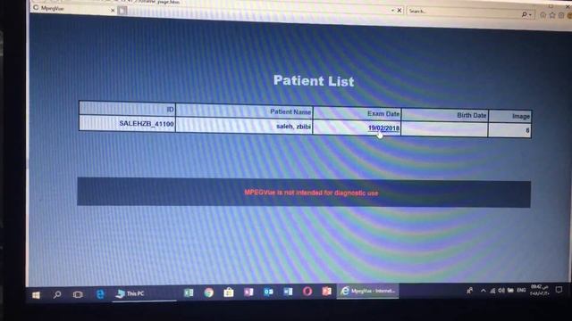 ge program viewer for ultrasound mpegvue