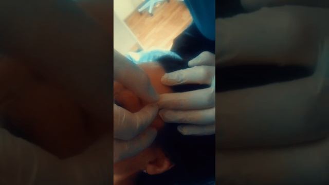 Иглотерапия. Акупунктурный лифтинг лица. Обучение.