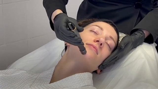 Фракционная мезотерапия лица