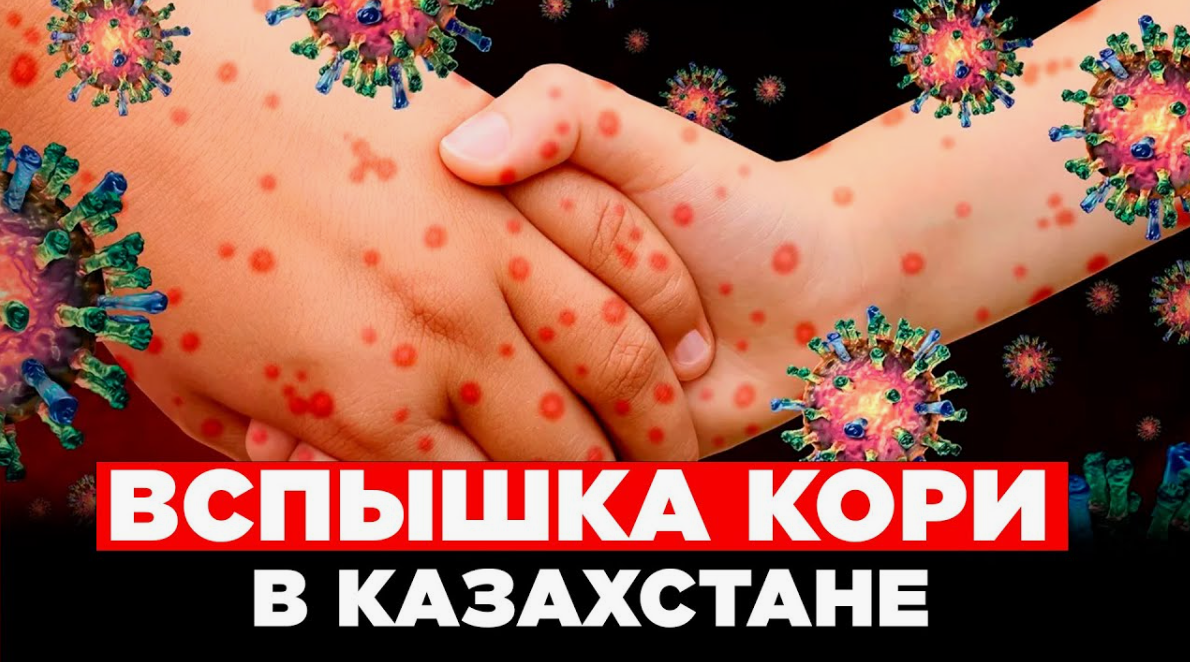 #Аврора #гадание Эпидемия кори в Казахстане 2024