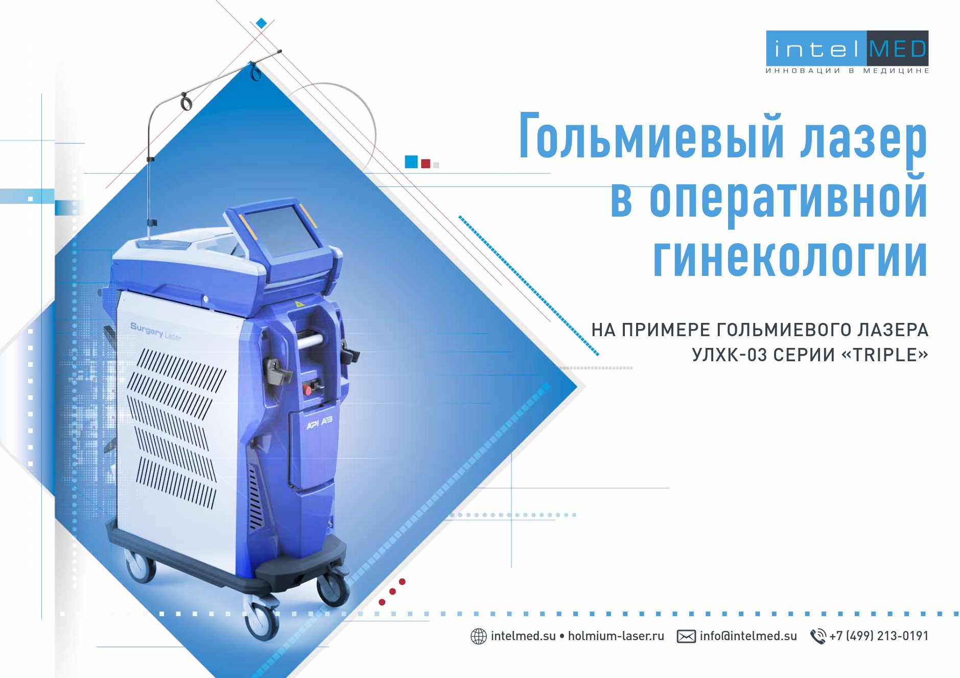 Киста яичника.