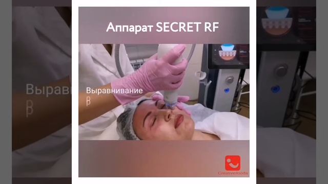 SECRET RF