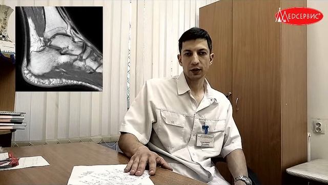 Почему болят пятки? У мужчины была выявлена пяточная шпора, но боль была по другой причине