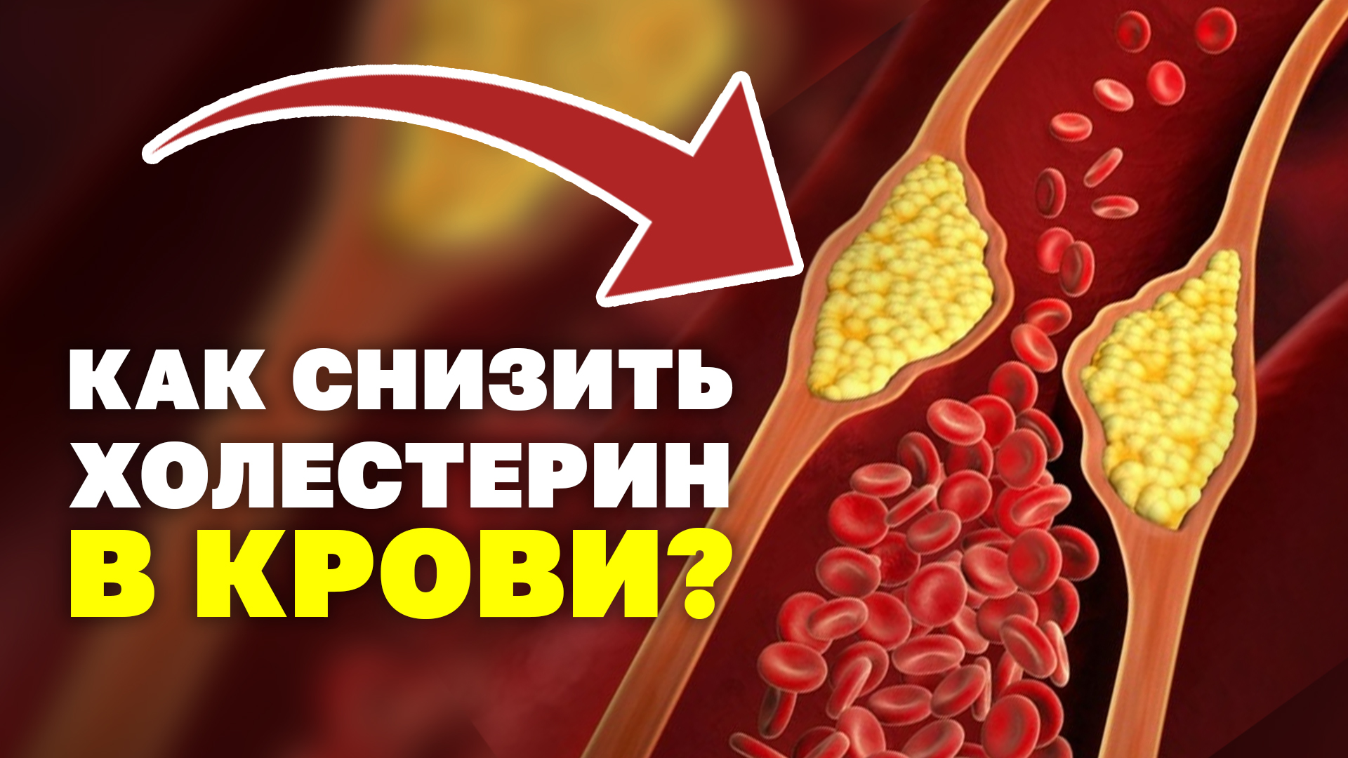 Как снизить холестерин? простые способы! Высокий сахар и холестерин в крови, что делать? Упражнения!