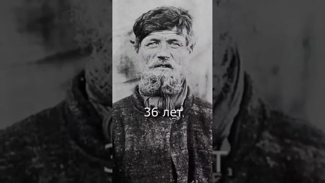 Как остановить старение без операции и 💉 красоты? #еленамихееваsw shorts *антиэйдж #молодость #зож