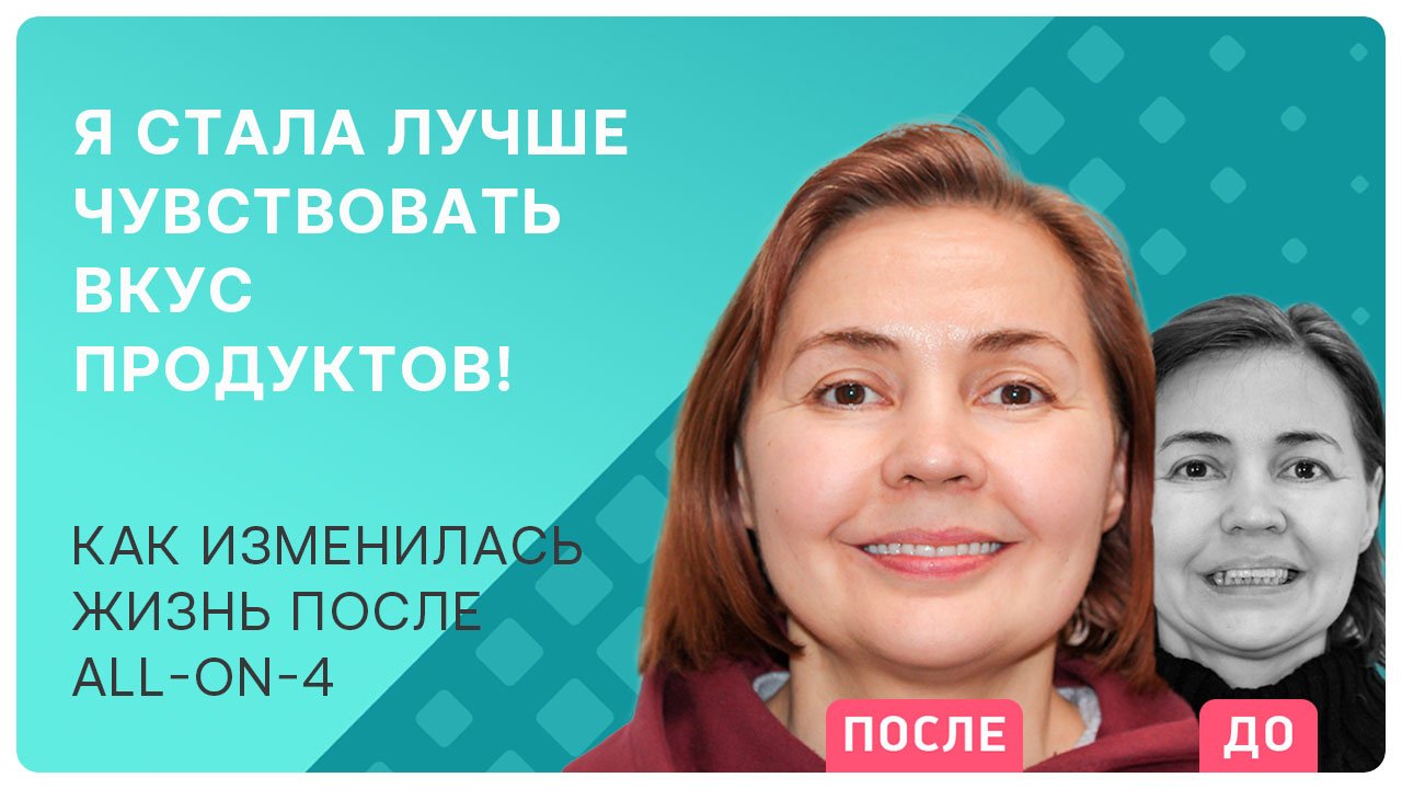 Как питаться вкусно! Откровенный рассказ пациентки после имплантации all-on-4