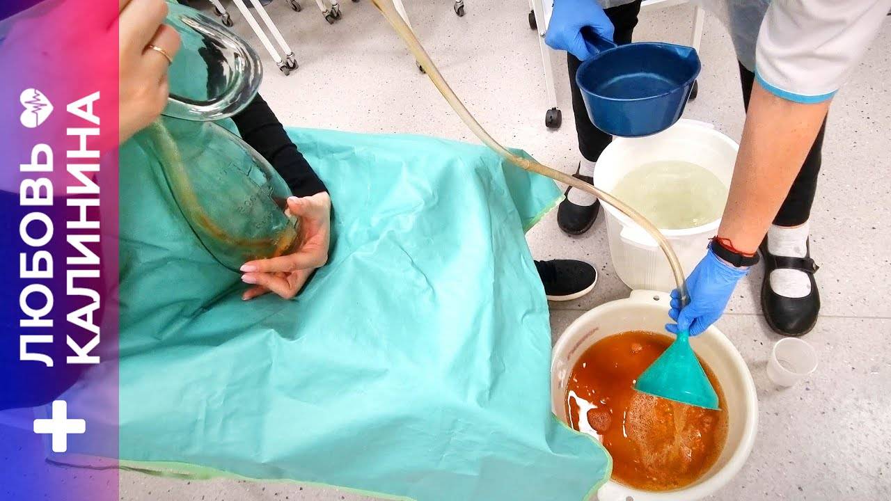 10. Промывание желудка толстым зондом | Л.Калинина