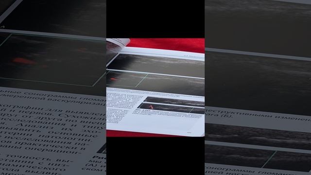 Ультразвуковая диагностика в травматологии и ортопедии