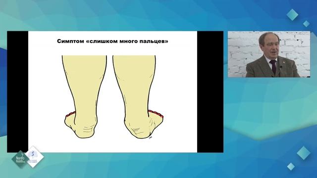 Подготовка стоп к занятиям скандинавской ходьбой - доклад профессора Фролова В.А.