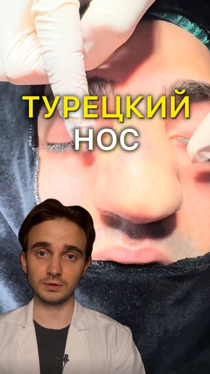 Турецкие носики