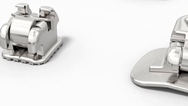 American Orthodontics Empower Self Ligating Braces
