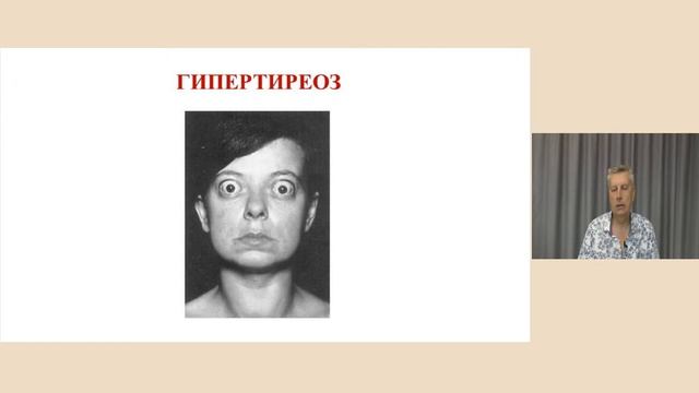Аутоімунні захворювання щитоподібної залози. Порушення функції щитоподібної залози.