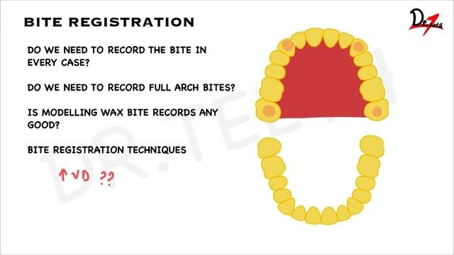 Bite Registration Techniques For Crowns & Bridges
