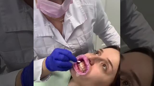 Отбеливание зубов vladimirskaya_k