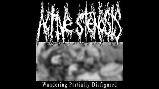 ACTIVE STENOSIS - WANDERING PARTIALLY DISFIGURED [2023]