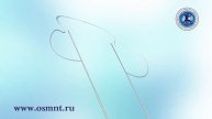 ОСМНТ нитевой лифтинг схема установки нитей конфигурации "H" область бровей