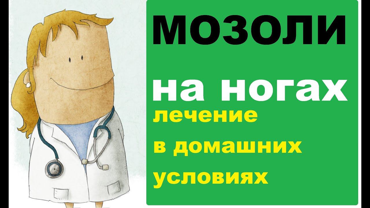 Мозоли на ногах: лечение в домашних условиях