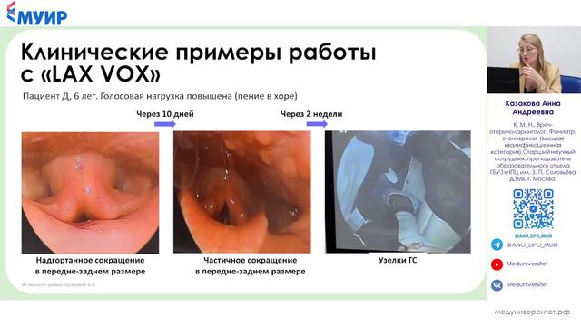 Бесплатный интенсив по Фонопедии 2 день!