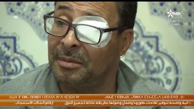 انزكان: تكفل ملكي باستشفاء الفنان احمد عوينتي