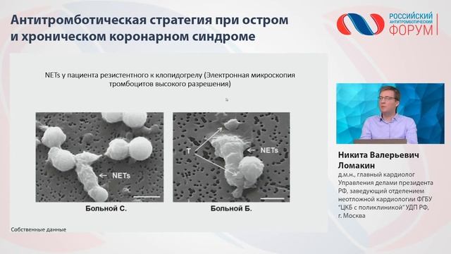 Антитромботическая стратегия при остром и хроническом коронарном синдроме