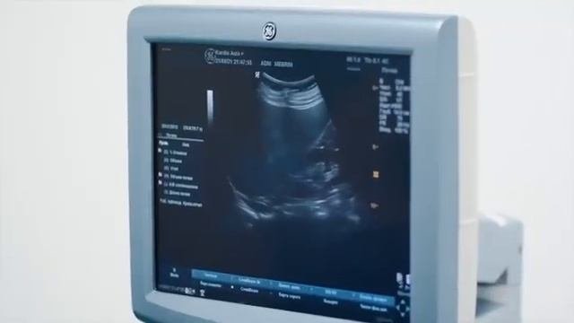 УЗИ всех органов! г.Ош