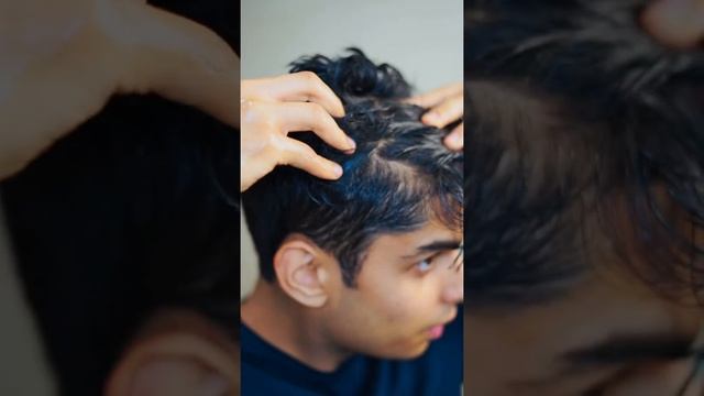 Increase ✅ HAIR GROWTH? and volume #Shorts | Tejas Yadav