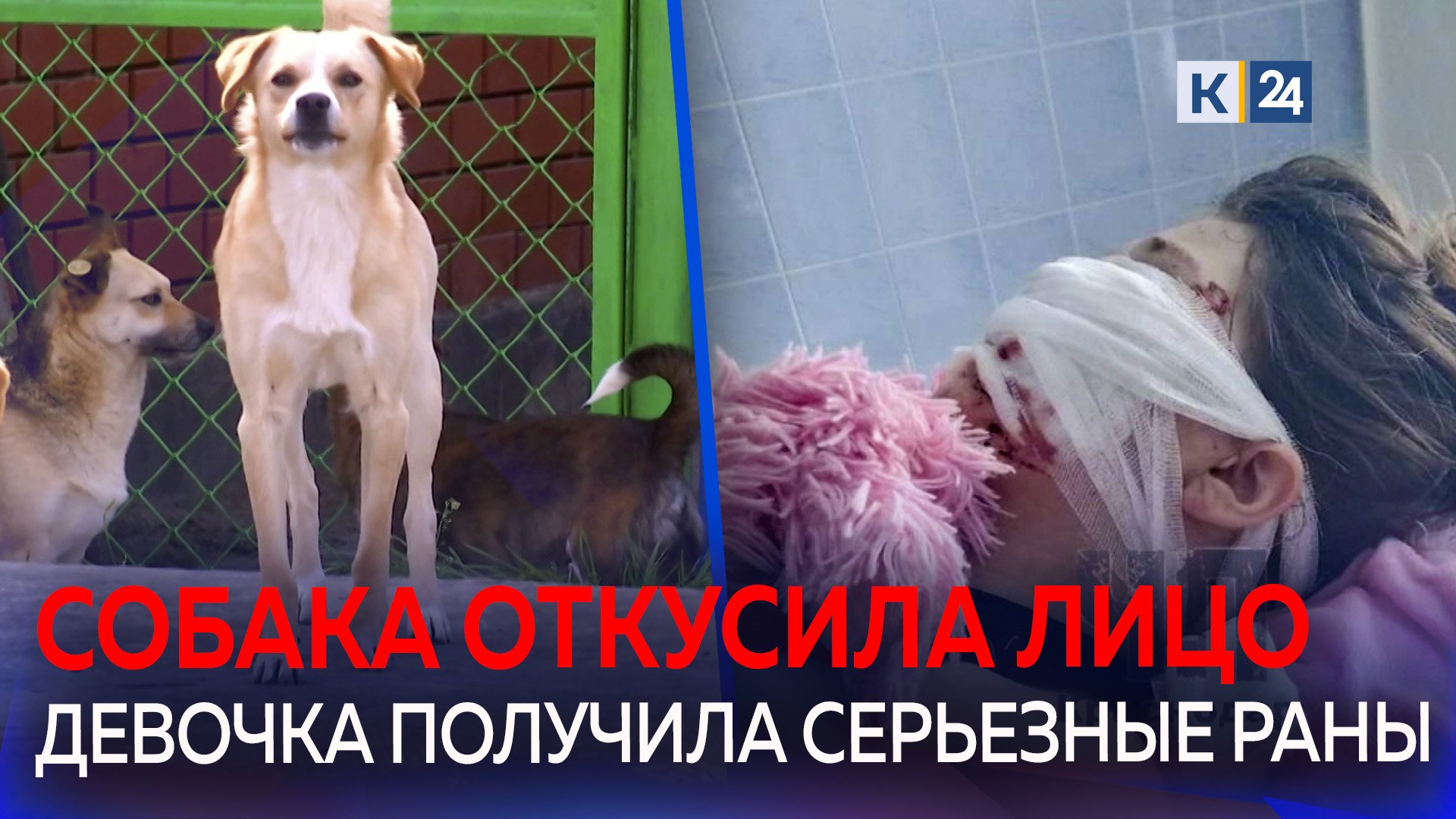 На Кубани разъяренный пёс откусил школьнице лицо