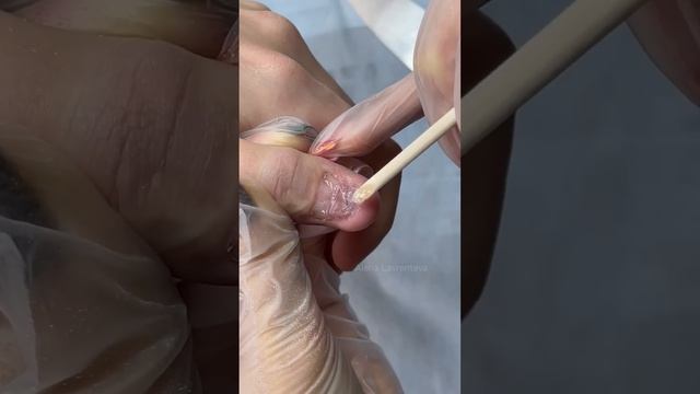 Неудачно удалил бородавку и теперь ноготь не растет/ Протезирование ногтей #nails #маникюр #гельла