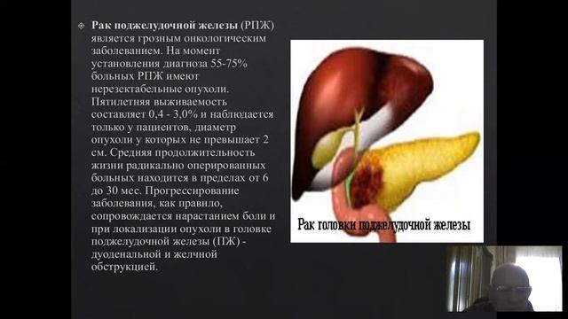 РАК ПОДЖЕЛУДОЧНОЙ ЖЕЛЕЗЫ