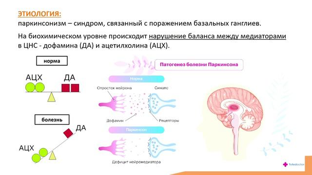 5.3. Паркинсонизм. Болезнь Паркинсона