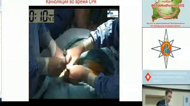 Шелухин Д.А. "Использование ЭКМО в многопрофильной клинике"