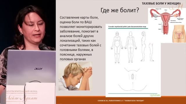 Тазовые боли у женщин. проф. М.М.Сонова, 6.11.2016