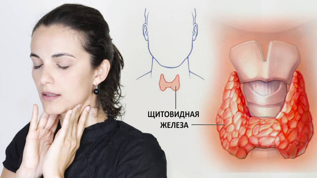 Многие заболевания начинаются  со щитовидной железы. Важность йода в организме