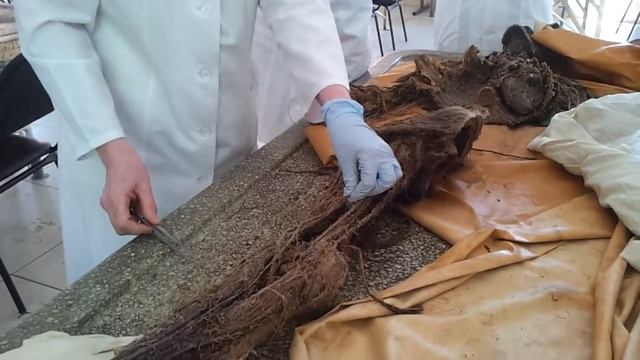 Крестцовое сплетение