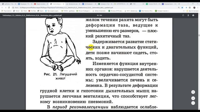 Рахит