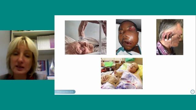 Принципы оказания и виды нутритивной поддержки в паллиативной медицинской помощи - Невзорова Д.В.