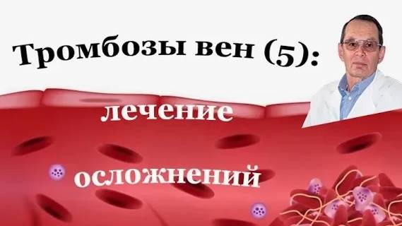 Тромбоз вен, осложнения. Профилактика и лечение  посттромботической болезни. Знания для ВСЕХ.