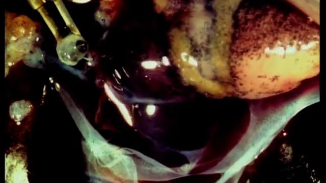 Изолированное сердце лягушки: аритмии