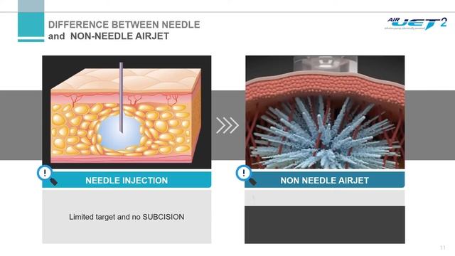 No Needle Hydrodynamic & Kinetic energy 3D Jet Lifting & Subcision Device  NO PAIN, SIDE EFFECT
